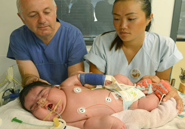 سنگین ترین نوزاد جهان به دنیا آمد