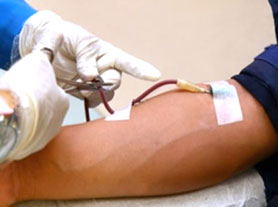 برخی دریافت‌کنندگان خون در معرض هپاتیتc