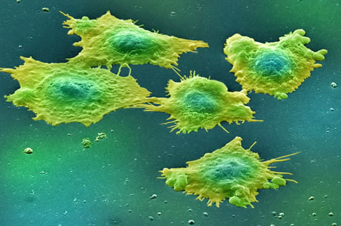 تاثير گرسنگی سلولی بر درمان سرطان