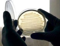 کشف محل جدید اختفای باکتری ذات‌الریه