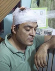 عکاس ایرانی در كابل زخمی شد+عكس