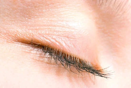 علل پرش پلک چشم چیست ؟