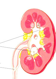 با علائم سنگ کلیه آشنا شوید!