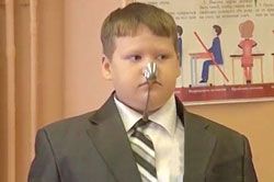 پسربچه روس: برق‌گرفتگی مرا آهنربا کرد!