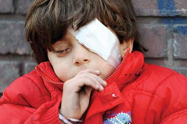 عامل نابینایی دختر 4 ساله قصاص می شود