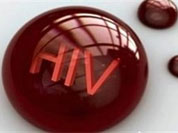 اولین علایم ایدز در دهان