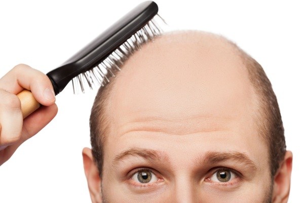 ریزش موهایتان را با موچین درمان کنید!
