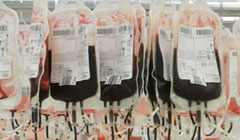 تغییر گروه خون اهداشده امکانپذیر شد