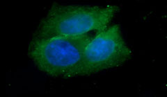 کشف پروتیین عامل رشد سلول سرطانی
