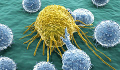 شناسایی زودهنگام سرطان با نانوذرات آهن