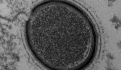 کشف یک ویروس 30 هزار ساله در سیبری