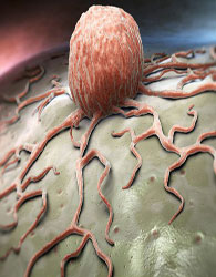 کشف پروتئینی که ترمز سرطان خون است