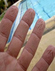 راز چروک شدن انگشت‌ها در آب