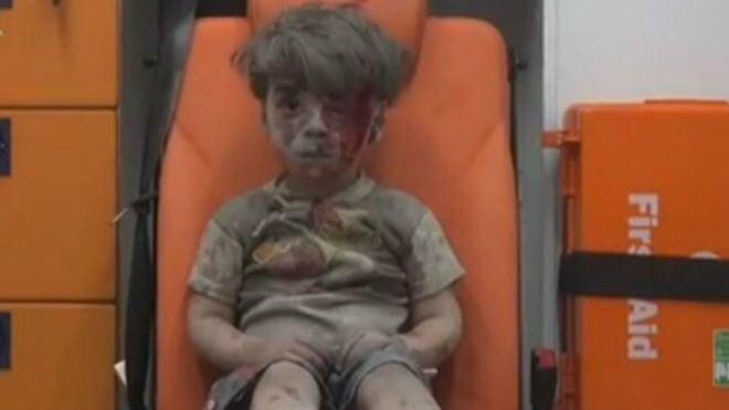 انتشار گسترده تصاویر این پسر ۵ ساله که در بمباران دیروز حلب توسط جنگنده‌هاي روسي با حالتی مات و مبهوت در آمبولانس نشسته شبكه‌هاي تلويزيوني و اجتماعي جهان را منقلب کرد.