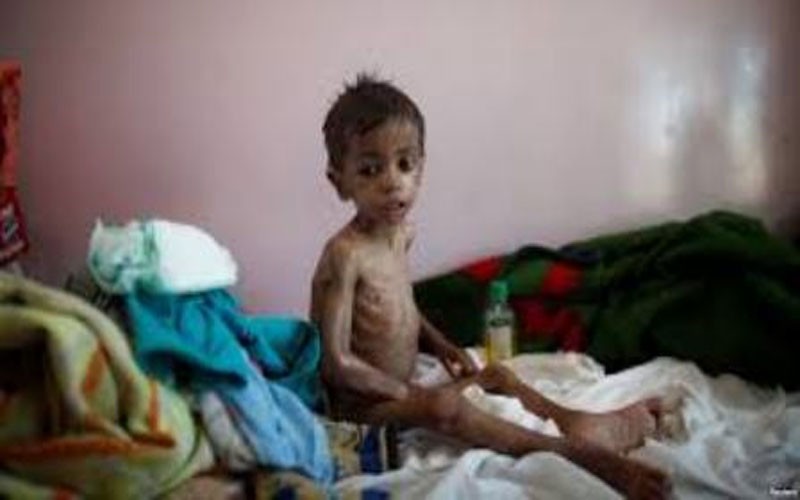 بحران غذا در یمن رو به وخامت است