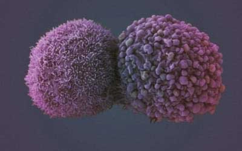 فناوری نانو به جنگ سلول‌های سرطانی می‌آید