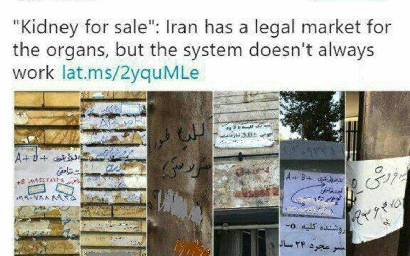 ايران؛ ركورددار فروش اعضاي بدن به خاطر فقر
