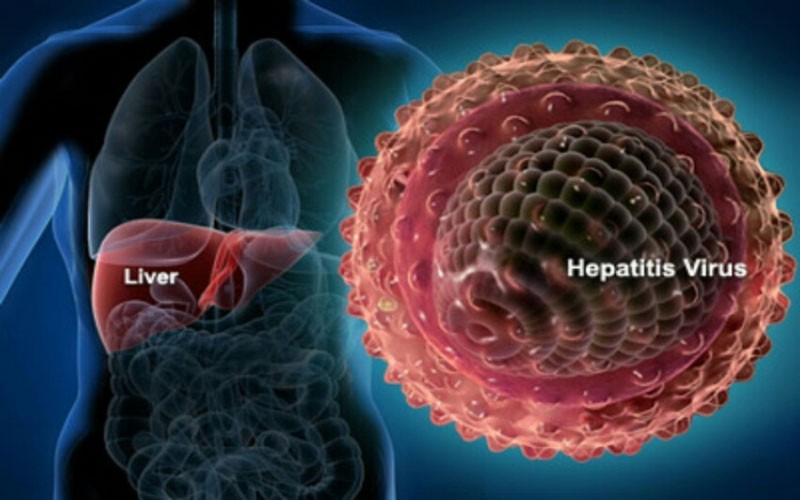 درمان نشدن هپاتیت و احتمال ابتلا به سرطان کبد