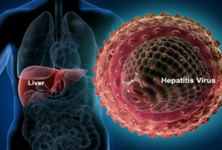 درمان نشدن هپاتیت و احتمال ابتلا به سرطان کبد