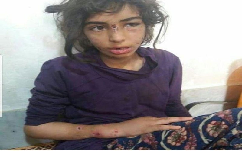 آخرین وضعیت کودکان شکنجه‌شده ماهشهری