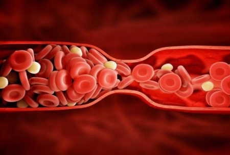 عوامل تاثیرگذار بر افزایش خطر لخته شدن خون