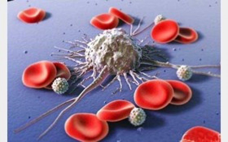 با علایم سرطان خون آشنا شوید