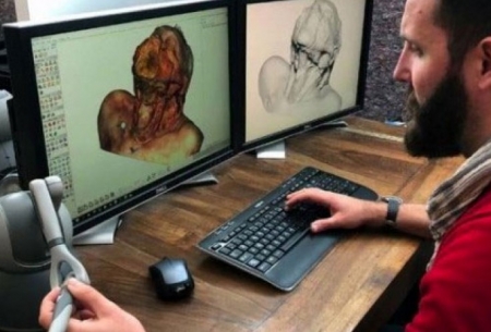آموزش جراحان مبتدی با فناوری مجازی