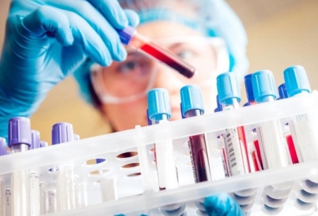تشخیص سرطان کبد با آزمایش DNA