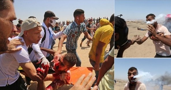 چهار شهید و ۶۲۰ زخمی در مرزهای غزه