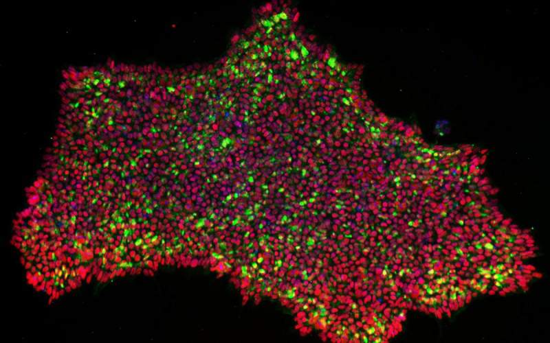 تولید سلول های بنیادی پرتوان از پوست
