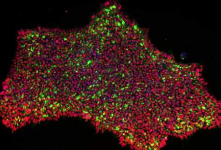تولید سلول های بنیادی پرتوان از پوست