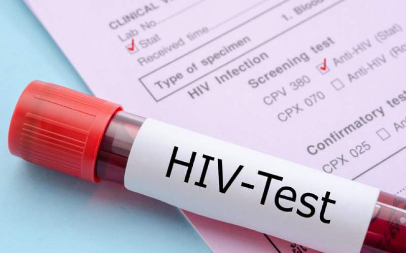 نتایج آزمایش "واکسن HIV" در فاز انسانی