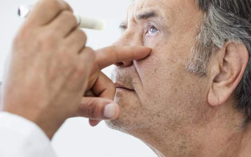 درمان «ماکولا» با تولید نوعی قطره چشمی
