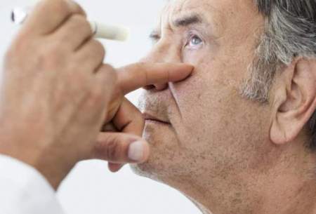 درمان «ماکولا» با تولید نوعی قطره چشمی
