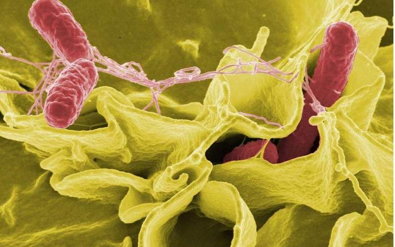 تشخیص بیماری های باکتریایی با نانو تراشه