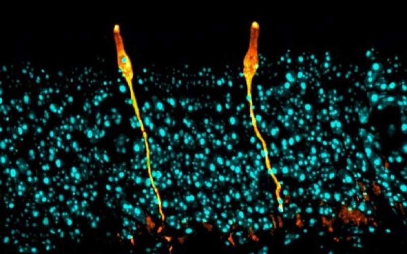 کشف سلول با قابلیت درمان فیبروز سیستیک