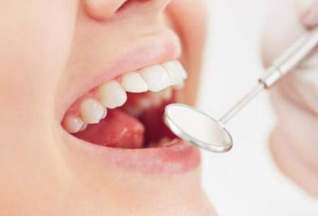 تاثیر باکتری‌های دهان بر سلامت ریه‌ها