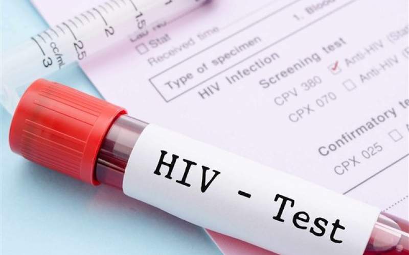 شناسایی ۳۶هزار مبتلا به ایدز در کشور