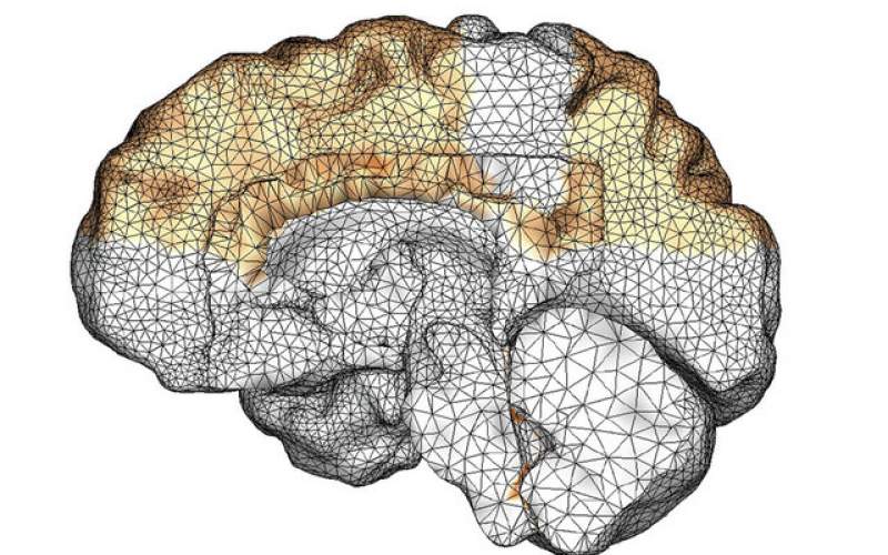 مدل‌سازی رایانه‌ای رشد آلزایمر در مغز