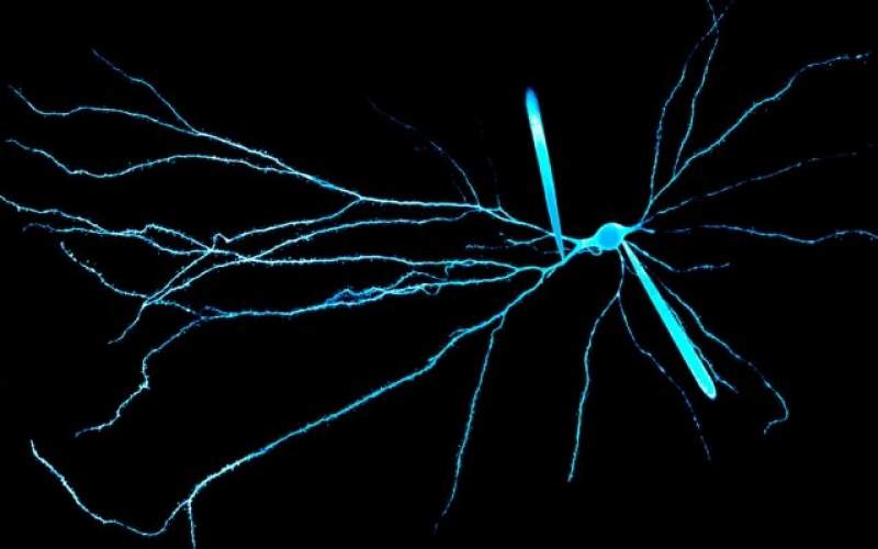 تاثیر جداسازی نورون‌ها بر قدرت محاسباتی مغز