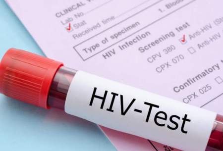 علائم HIV در زنان