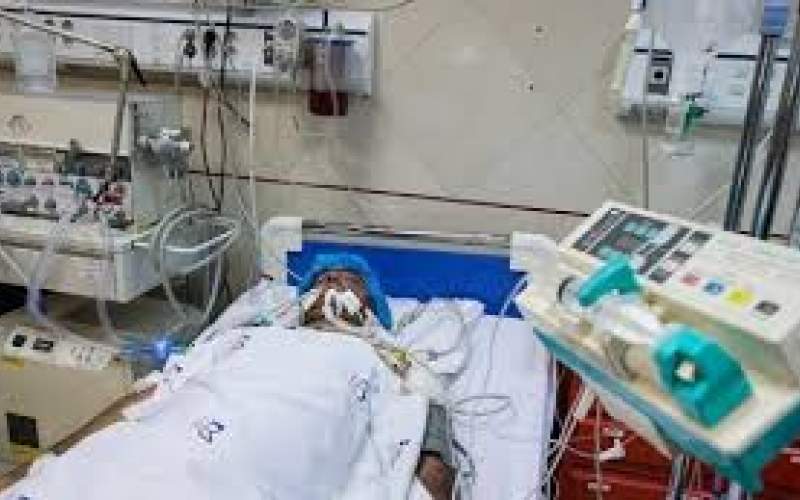 وقوع سالانه ۸ هزار مرگ مغزی در ایران