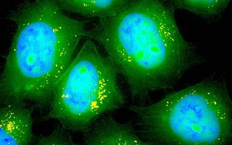 اسپری «mRNA» راهی برای درمان سرطان ریه