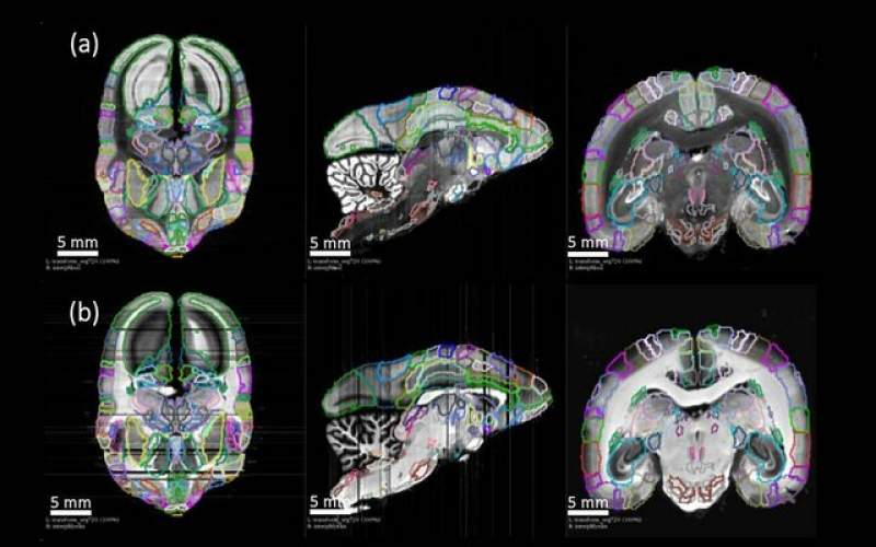 درک اتصالات نورونی با نقشه‌برداری ازمغز میمون