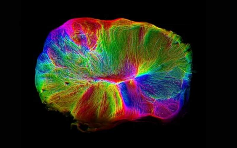 رشد یک مغز کوچک در دست دانشمندان
