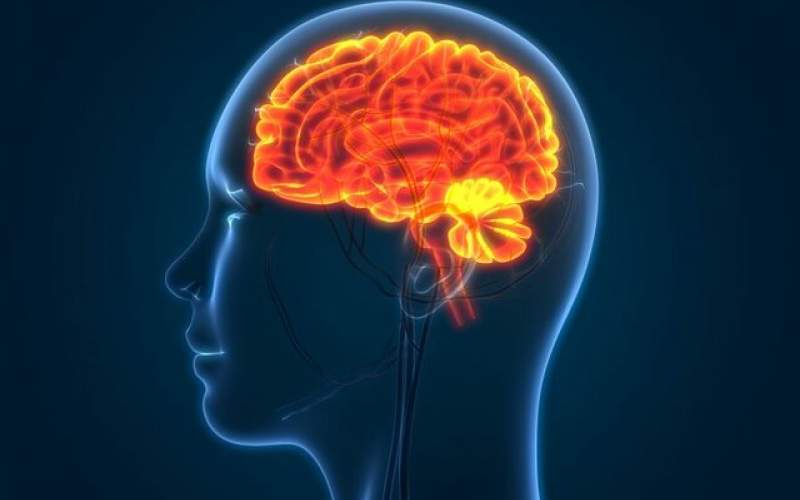 درمان تورم مغز پس از سکته با کمک ژن‌درمانی