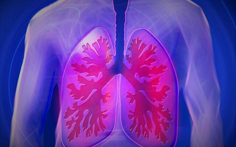 درمان آسم با کمک نخستین نقشه ریه انسان