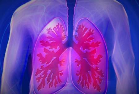 درمان آسم با کمک نخستین نقشه ریه انسان