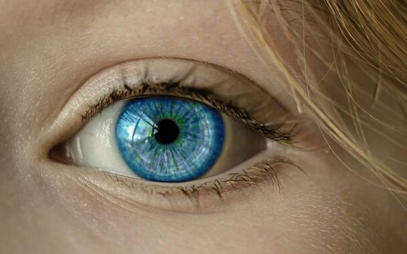 درمان تنبلی چشم بابررسی ۲مسیرجداگانه مغز