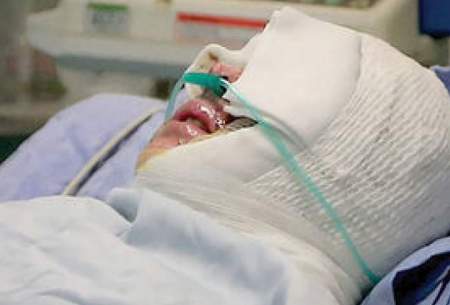 اسیدپاشی به دختر و پسرِ تهرانی سرقرار